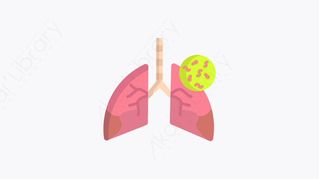 图片素材-032_感染肺_infected_lungs